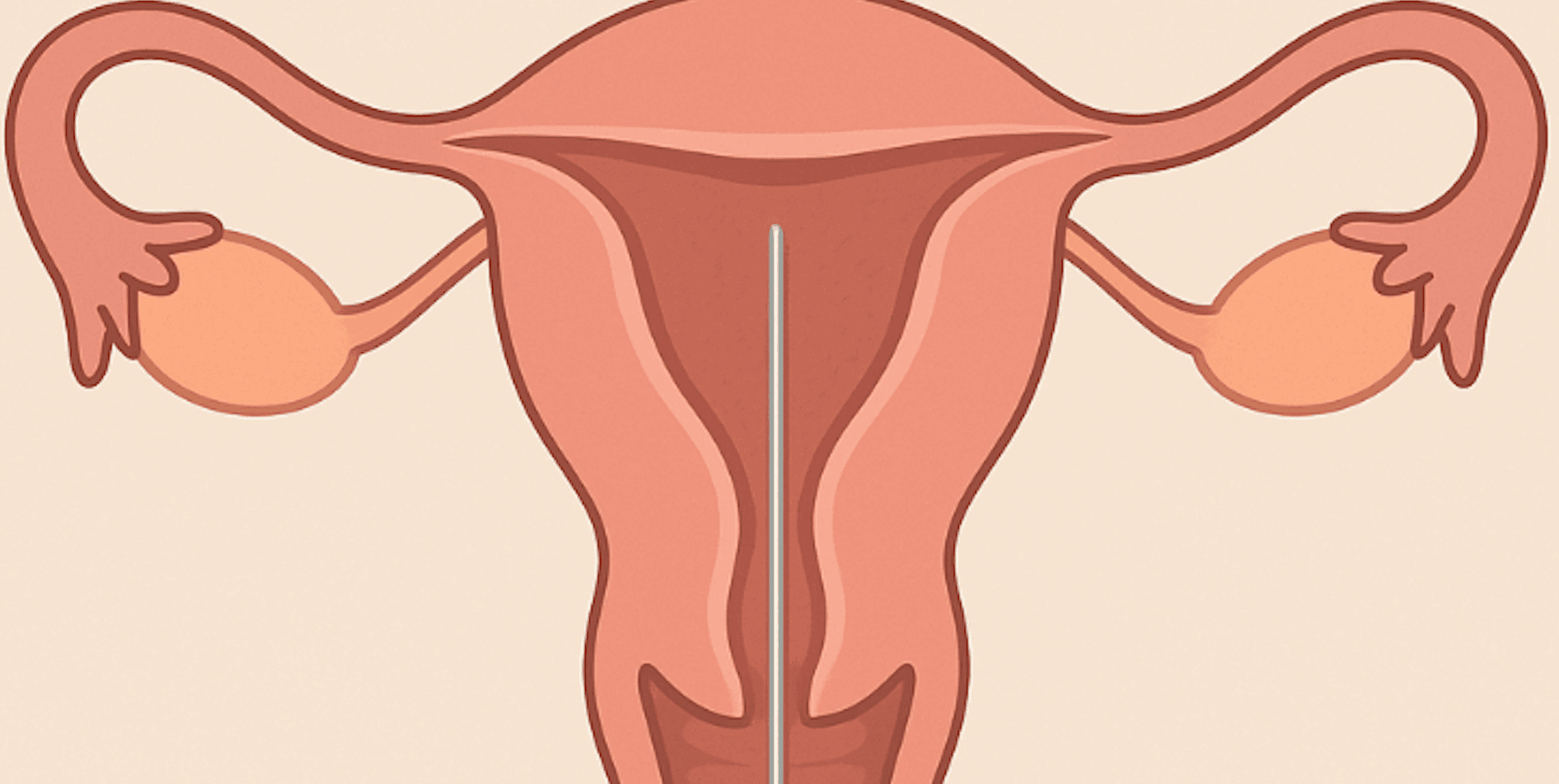 Endometrial Biyopsi (Probe)