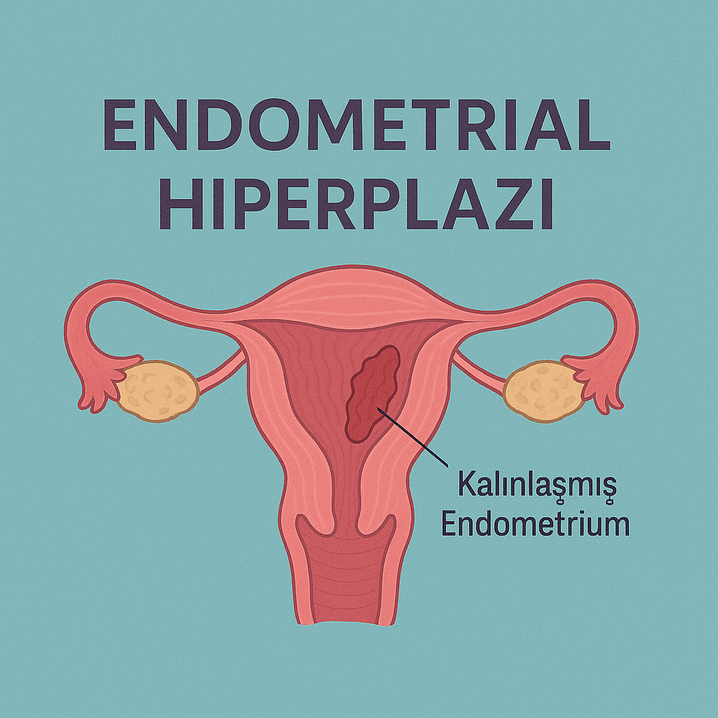 Endometrial Hiperplazi