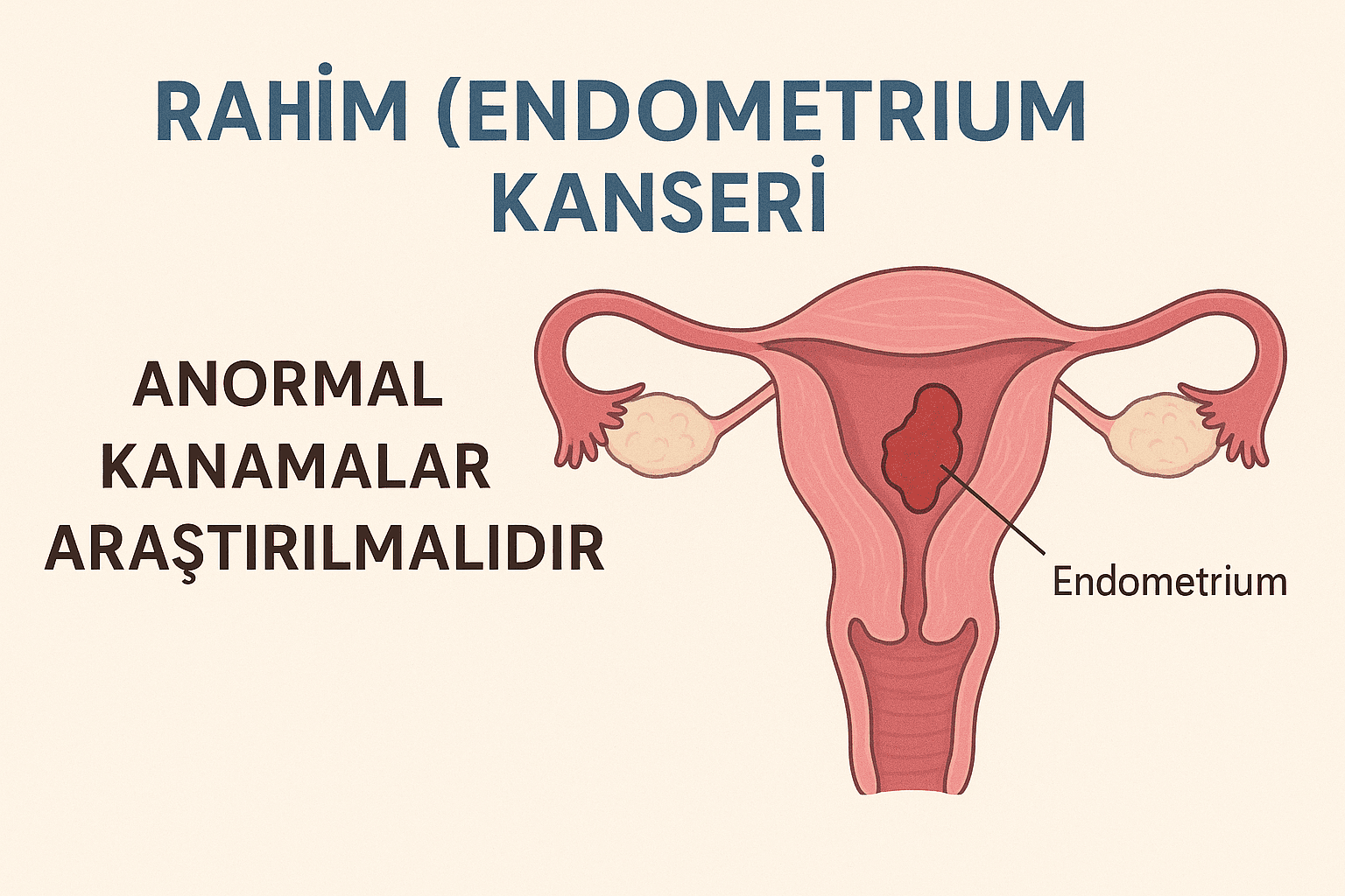 Rahim Kanseri (Endometrium)