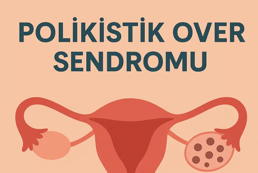 Polikistik Over Sendromu // PMOS – Polyendocrine Metabolic Ovarian Syndrome