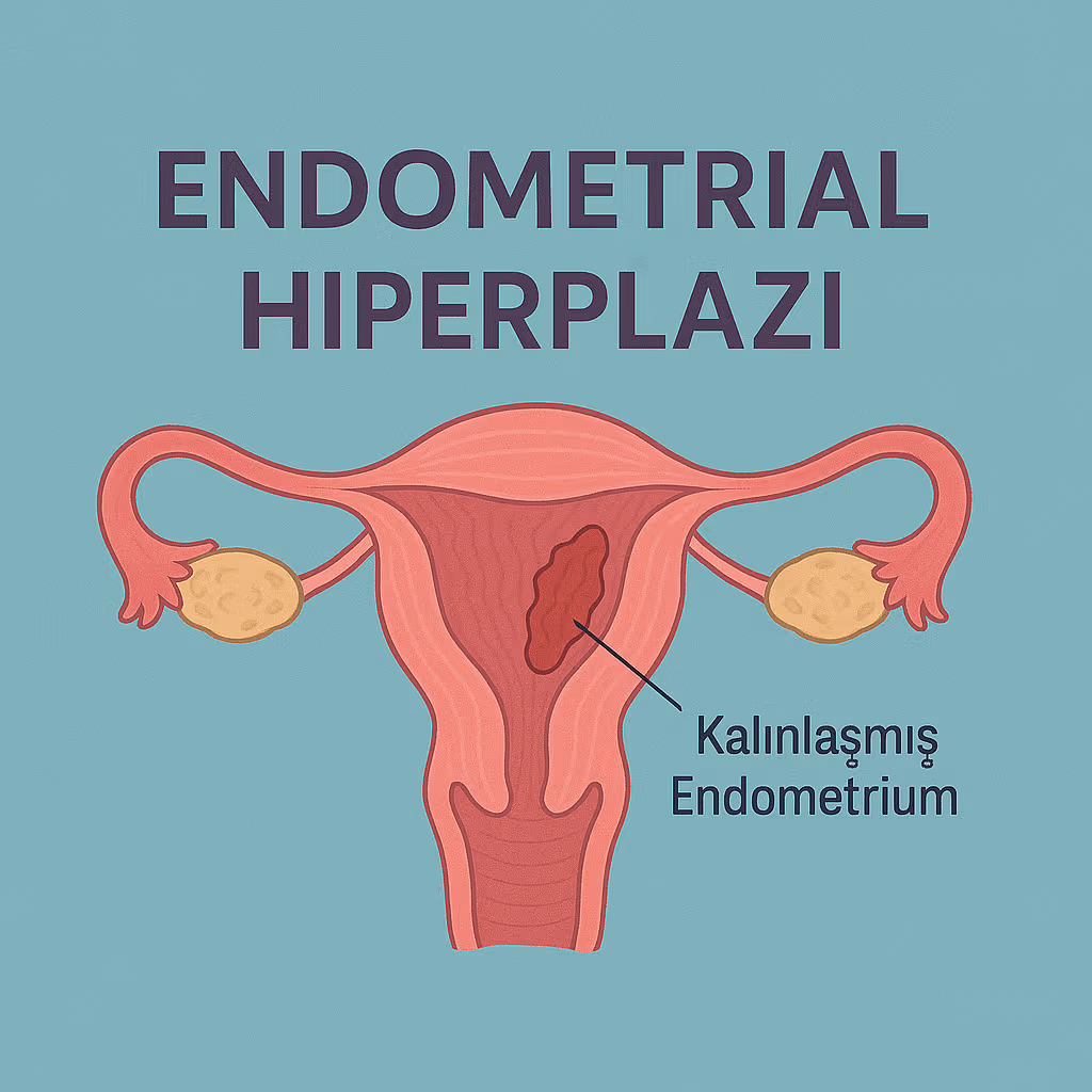 Endometrial Hyperplasia