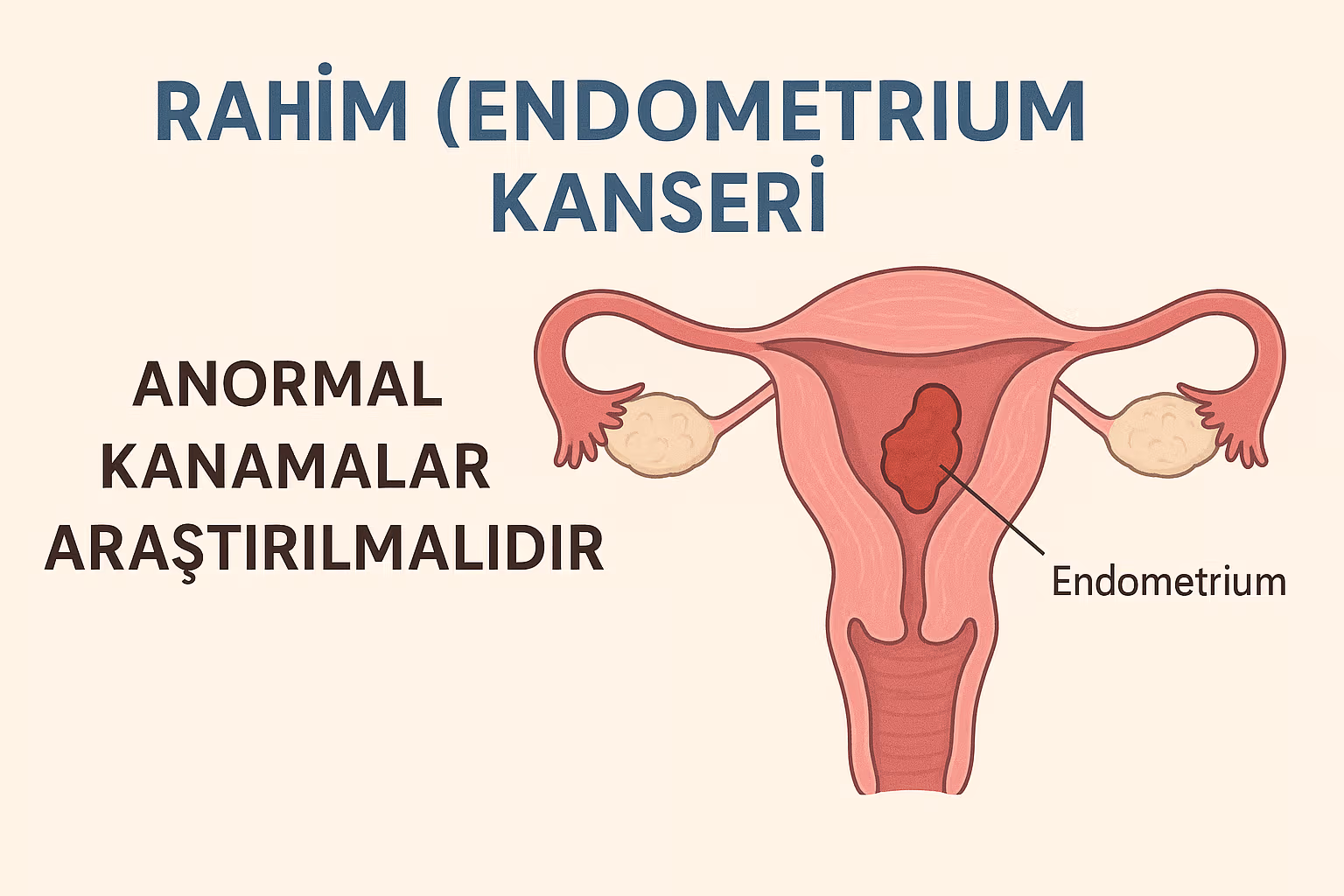 Uterine Cancer / Endometrial Cancer